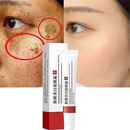 Crema blanqueadora para pecas, crema de tratamiento para eliminar cicatrices de...